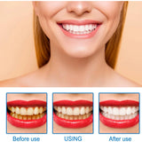 Essência de Clareamento Dental